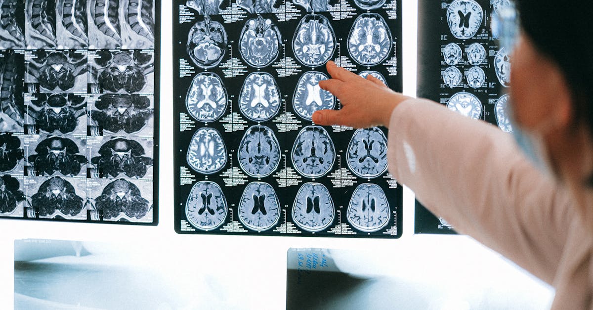 Bilan de santé au travail : un atout pour les recruteurs
